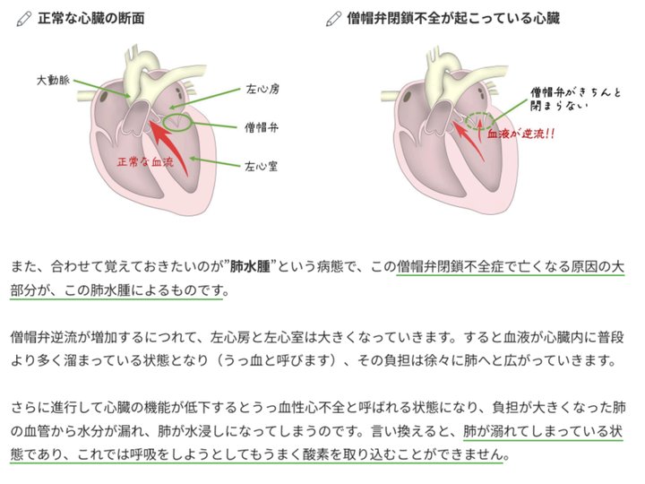 心臓のイラストで解説した僧帽弁閉鎖不全症の記事